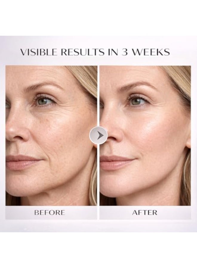 Volufiline 92% + Pal-Isoleucine 1% Plumping Serum Support Facial Plumping, Anhydrous Marionette Lines Serum for Smoother Skin Hollow Cheeks Eyes Cheeks Smile Lines - Image 3