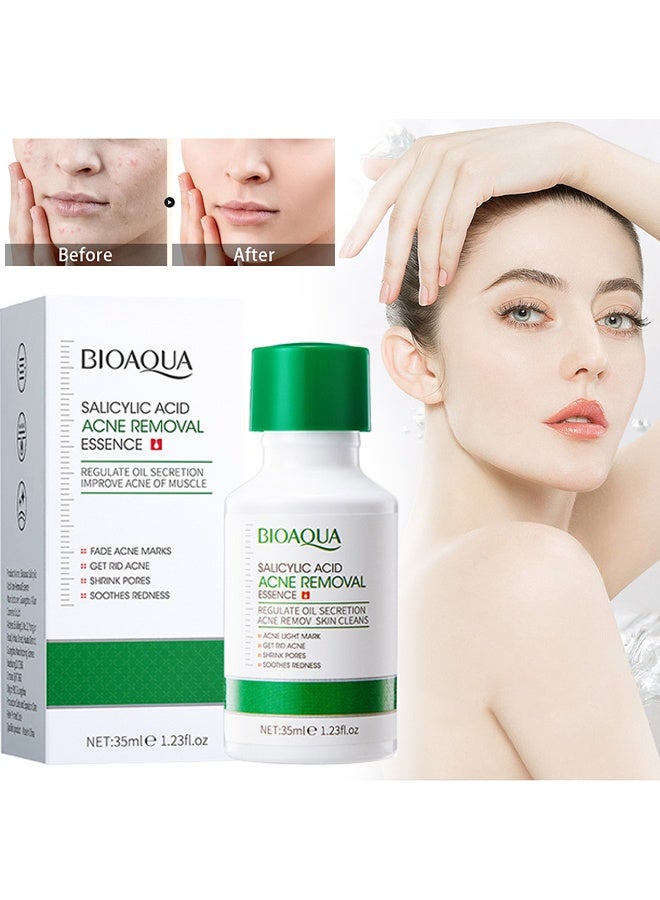 BIOAQUA Salicylic Acid Acne Removal Essence -  Oily Skin | Helps Improve the Appearance of Enlarged Pores, Pimples, Blackheads and Uneven Texture, Moisturizing and shrinking Essence, 35 ml - Image 1