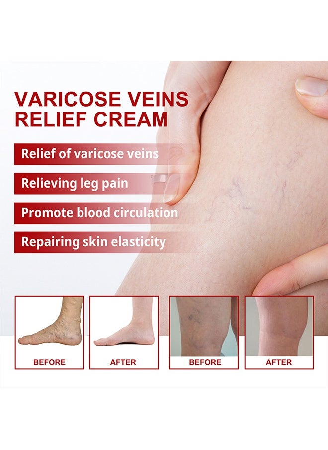 SOUTH MOON Varicose Veins Cream，Relieve Tired Legs Relieve Dilated Capillaries Minimize Varicose &Spider Veins ​Relief Cream 20g  - Image 2