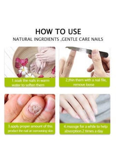 efero Nail Treatment Repairing Gel Nail Repairing Gel Eliminates 99.9% of Fungus & Bacterial Infections in Hand & Toe Nails Nail Damage Repair & for Healthy Nails for Men & Women 20g  - Image 4