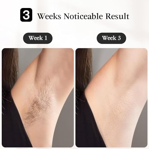 JOVS Laser Hair Removal, [24J Energy] IPL Hair Removal for Women and Men, 37°F Painless Sapphire Ice-Cooling Tech, 6 Modes for Whole Body Hair Removal Device, 2 in 1 Skin Rejuvenation, 330° Rotation - Image 4