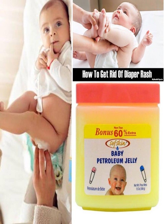 SOFSKIN (USA Brand) Baby Jelly with Shea Butter, Skin Protectant and Moisturizer, 226 gm, Nursery Care for Diaper Rash, Minor Cuts and Chapped Skin. Export Surplus. Paedratics recommended. (See Video) - Image 2