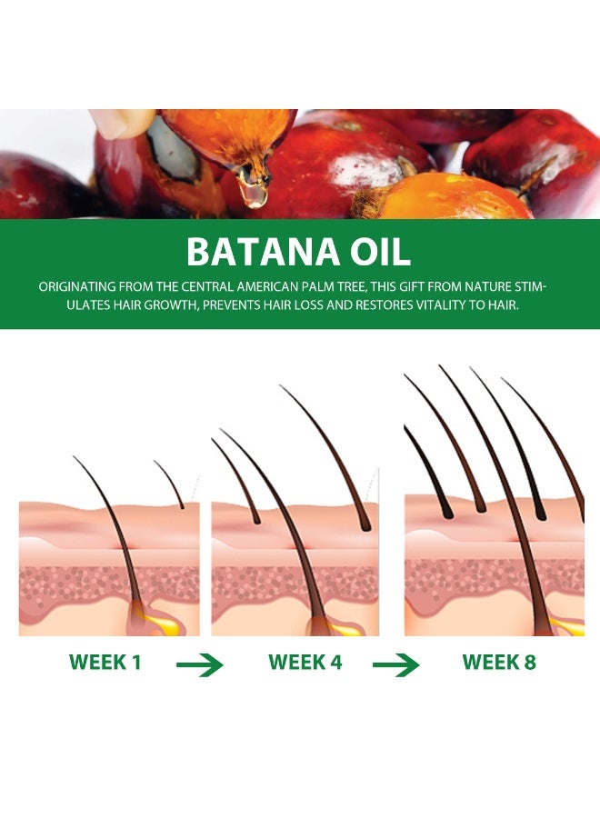 MOOYAM Batana Oil for Hair Growth 60ml,100% Pure Natural Batana Oil, Advanced Essential Oil for Hair Growth & Skin Care for Thin Hair Repair Damaged Hair Nourishes Loss Hair Growth Fit for All Hair Types - Image 5