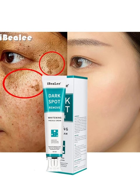 Dark Spot Remover for Face Peeling Skin Whitening Freckle Cream Pigmentation Treatment Sun Spots Age Spots Blemish Remover Lightening Cream