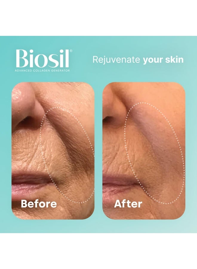 BIOSIL - 120 Vegan Capsules - With Patented Ch-Osa Complex - Increase Collagen Production For Beautiful Hair, Skin & Nails - Gmo Free - 120 Servings - Image 5