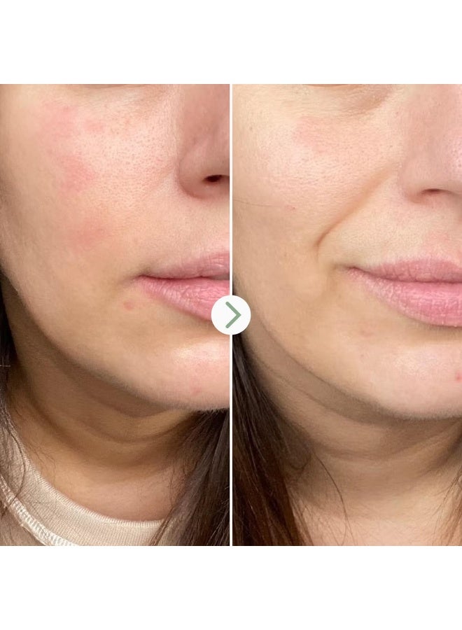 Pai Skincare Partners in Calm Cleanser & Moisturiser Set - Image 4