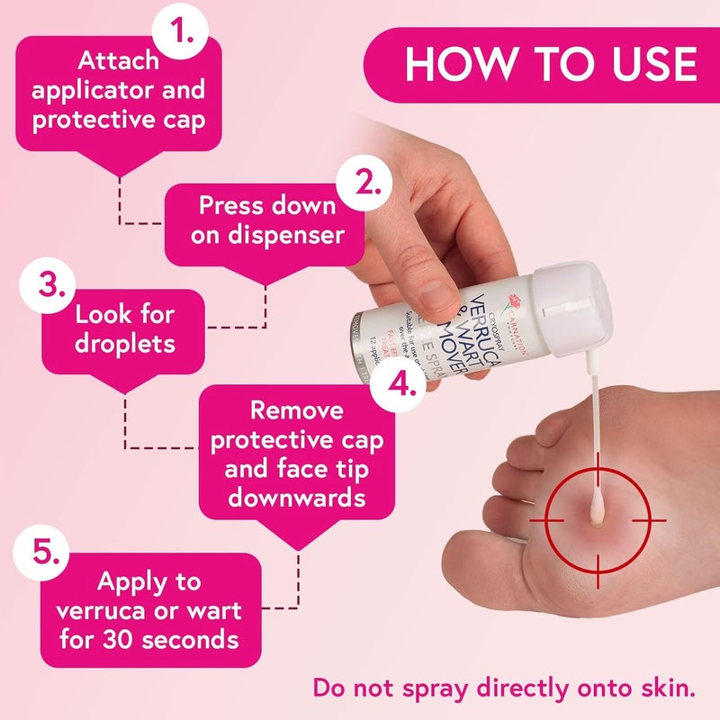 Carnation Footcare CARNATION Verruca and Wart Remover Freeze Spray 50 ml - Image 5