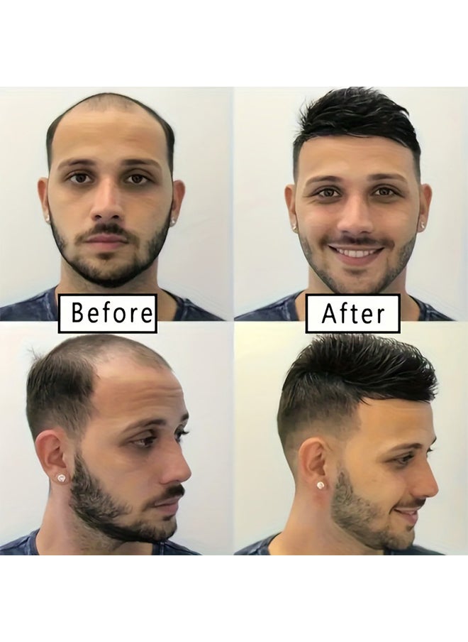 Generic Men's wigs short hair, head hair replacement blocks to cover gray hair Mediterranean bald men's hair replacement pieces  - Image 3