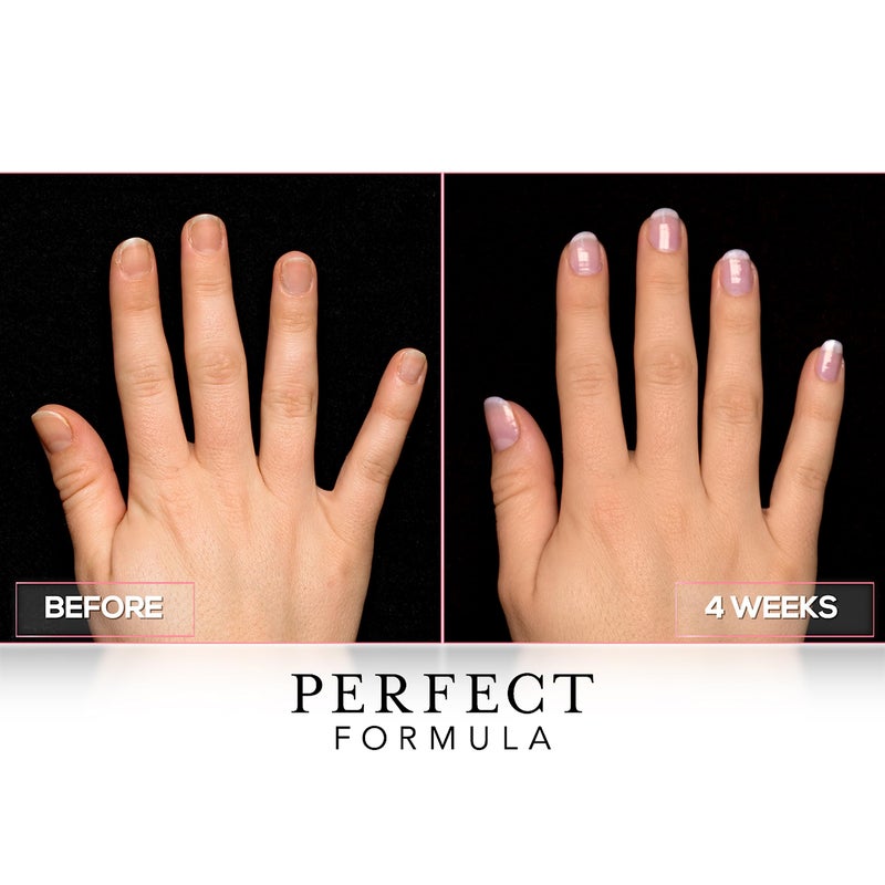 Perfect Formula Ruby Pink Gel Coat - Nail Strengthener, Keratin Nail Treatment, Gemstone Pink Gel Nail Polish - Nail Strengthener for Damaged Nails - Made In The USA .60 fl oz. - Image 5