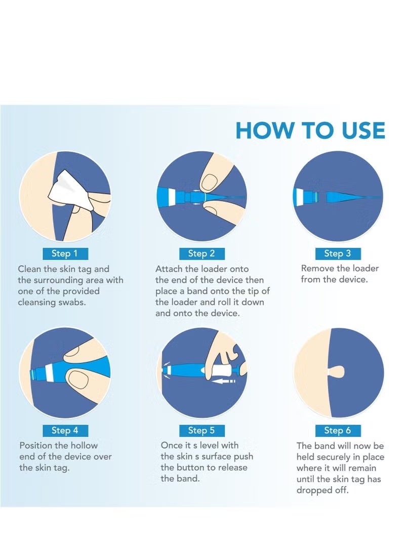 Sefudun Wart Removal Tool Skin Tag Removal Double Head Blue - Image 3