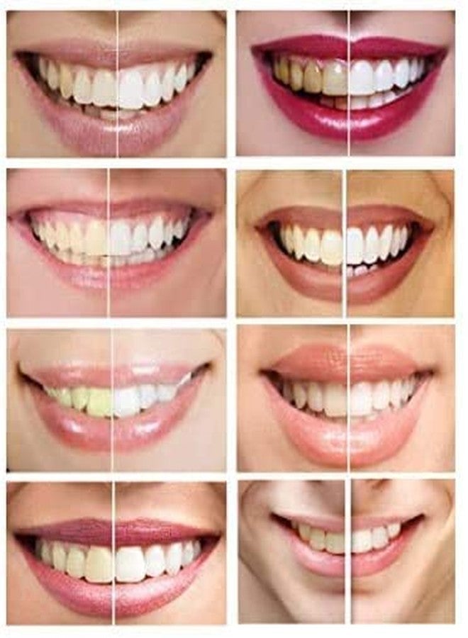 White Teeth Global جل تبييض الأسنان العالمي من وايت تيث 44% كارباميد بيروكسيد، 6 حقن جل تبييض الأسنان - Image 4