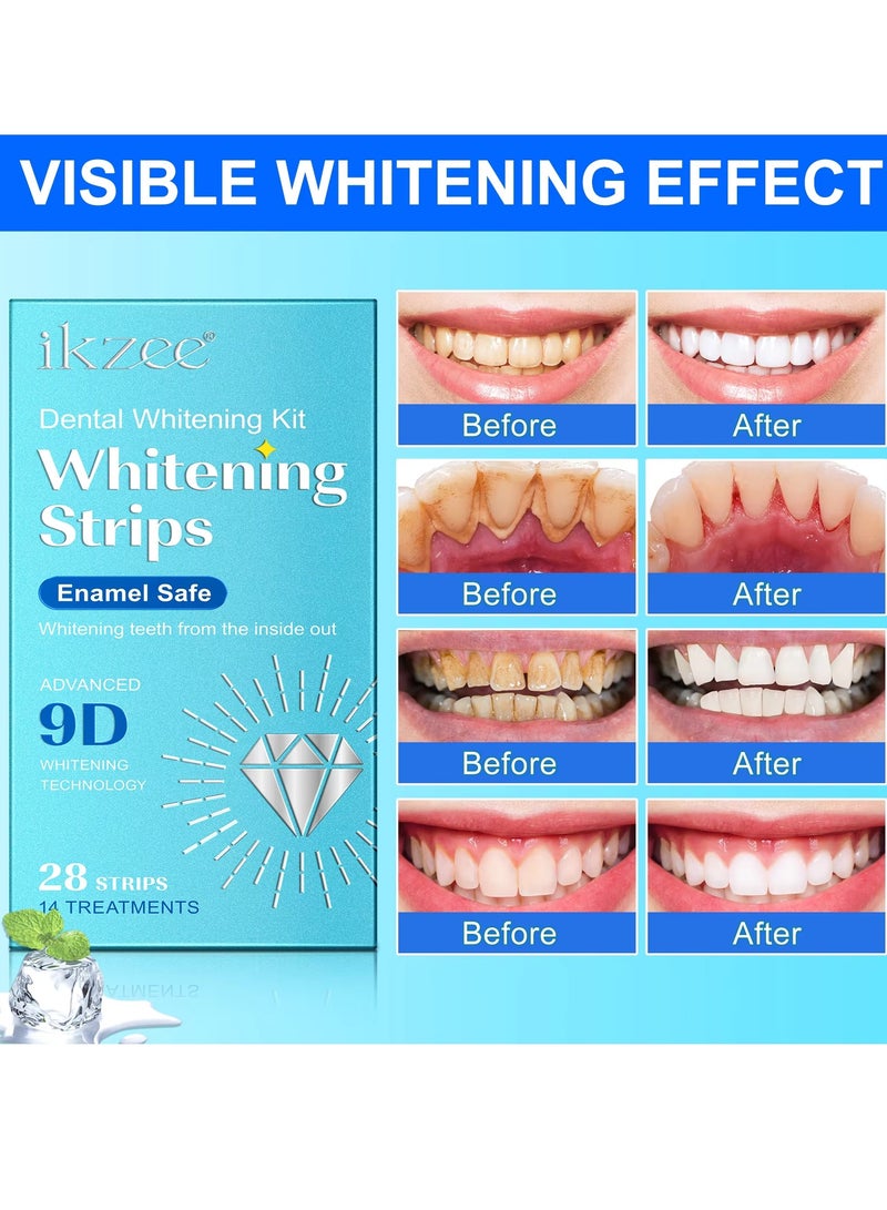 IKZEE 28pcs 9D Teeth Whitening Strips Upgraded Teeth Whitener Strips Enamel Safe Sensitive Teeth Whitening Individual Strips Gel Teeth Cleaning Strips for Fast Remove Yellowing Tooth Strips - Image 4