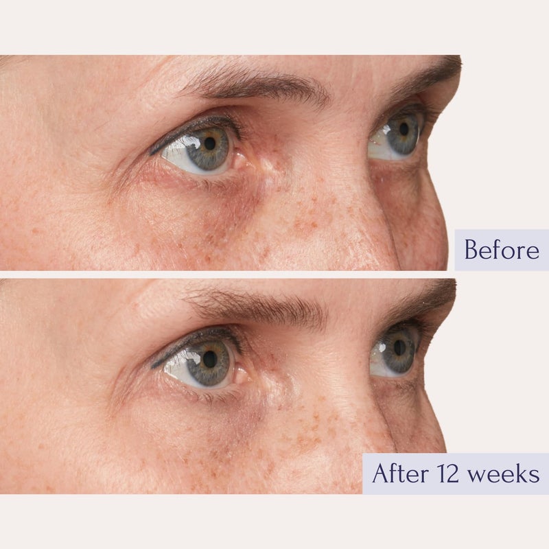 Tru Alchemy Eye Elixir Cooling Eye Treatment Cream - Dark Circle Eye Cream for Puffiness and Bags Under Eyes - Caffeine, Hyaluronic Acid, Vitamin C - Image 3