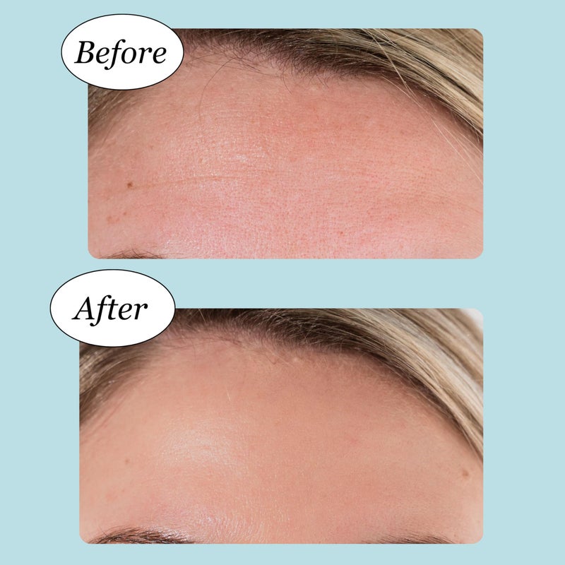 JANE VINE Forehead Wrinkle Patches - Anti Wrinkle Patches - Cooling Collagen Hydration - Wrinkles Treatment - Forehead Collagen Patches with Centella Asiatica, Vitamin E & Hyaluronic Acid - 20 Pcs - Image 3