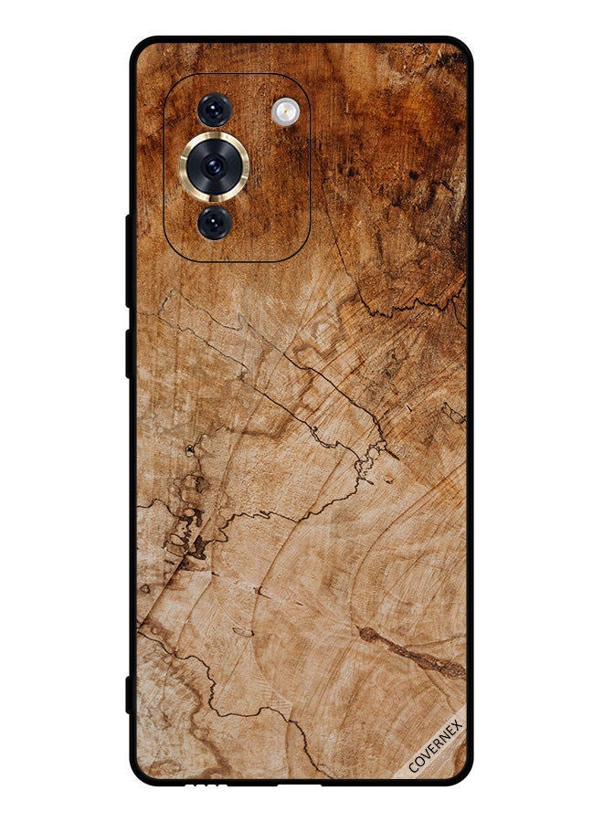 Covernex Protective Case Cover For Huawei Nova 10 Pro Vintage Wooden Pattern - Image 1