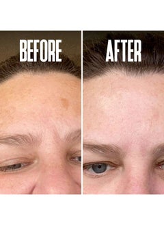 DIVINE DERRIERE Dark Spot Corrector, Dark Spot Remover for Face - For Stubborn Dark Spots Serum, Dark Spot Remover with Kojic Acid, Alpha Arbutin, Mulberry Extract, Brightening Discoloration Correcting Serum  - Image 5