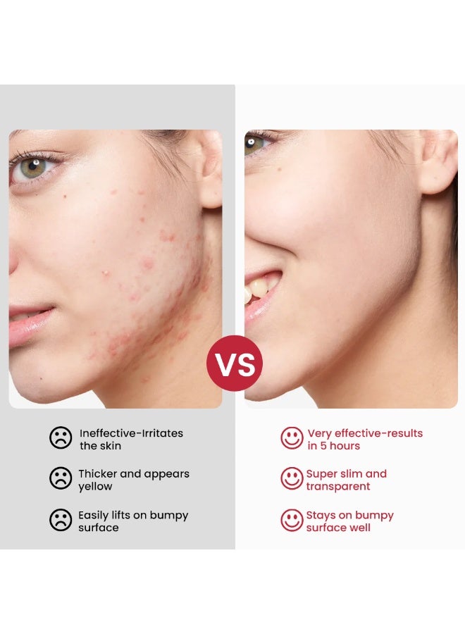 Sumifun Extra Strength Calamine Rosacea Ointment Cream - Image 3