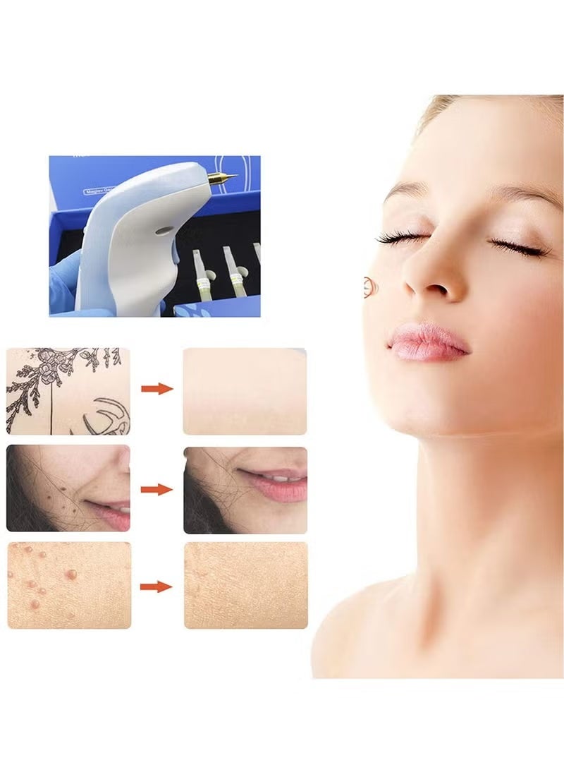 قلم البلازما لشد الجفون وإزالة التجاعيد – جهاز متكامل للعناية بالبشرة وإزالة الشوائب - Image 4