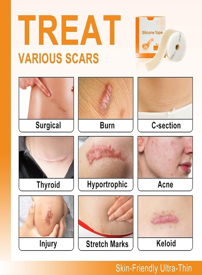 EASTHILL Silicone Scar (1" x 60"Roll), Soft Silicone Scar Tape for Scars Removal, Reusable Easy-Tear Silicone Painless Scar Removal for Surgery - Image 2
