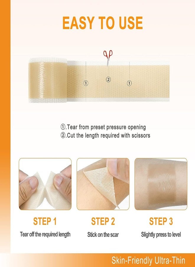 EASTHILL Silicone Scar (1" x 60"Roll), Soft Silicone Scar Tape for Scars Removal, Reusable Easy-Tear Silicone Painless Scar Removal for Surgery - Image 5