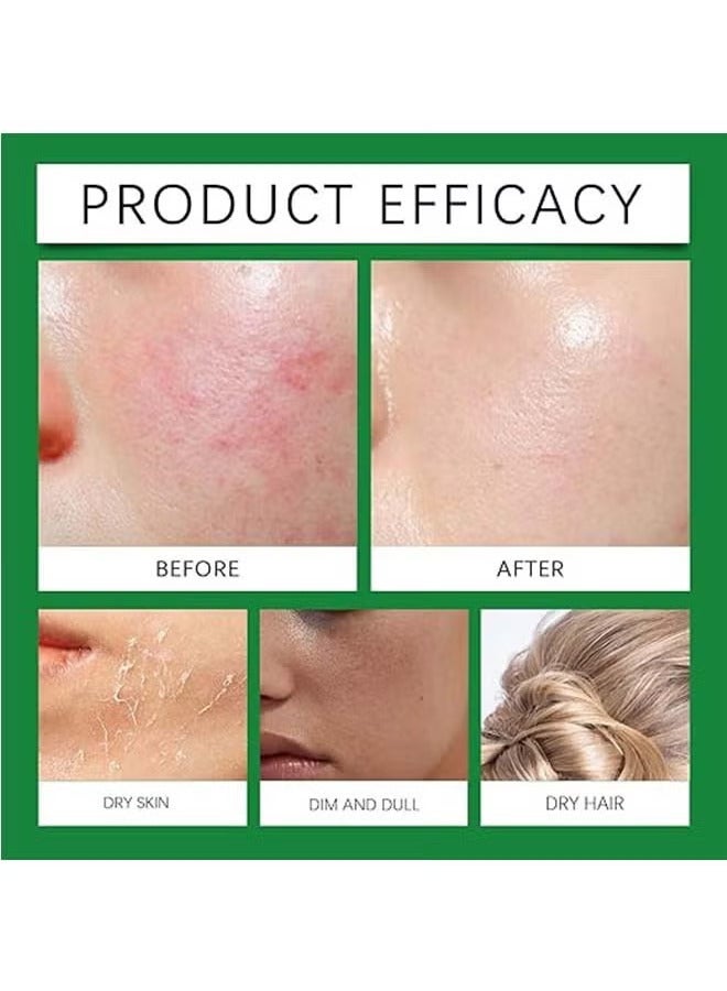 OceAura Aloe Vera Gel for Skin & Hair, Soothing Gel Moisturizer for Face and Body, Lightweight Non-Sticky Aloe Gel for Sunburn Relief and After Sun Care (100ml) - Image 3