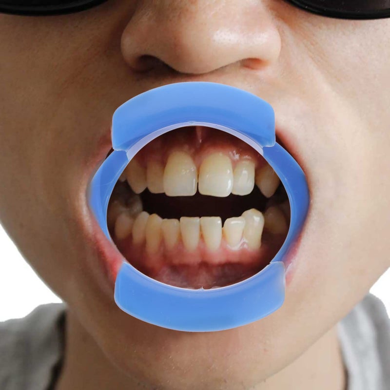 Healifty Orthodontic Mouth Opener Dental Cheek Lip Bite Block 7X6.7X1cm - Image 3