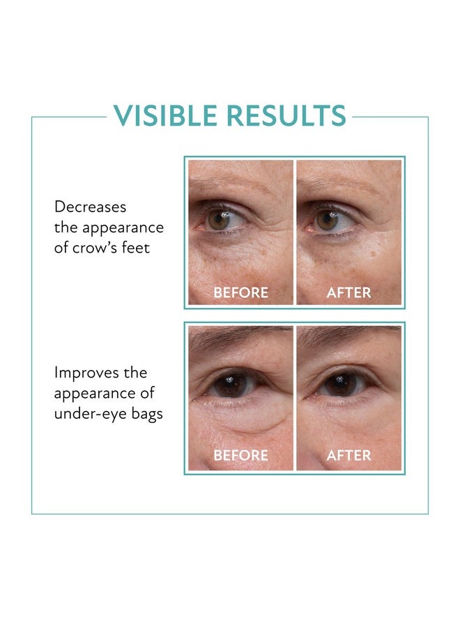 Westmore Beauty - Westmore Beauty 60 Second Eye Effects - Eye Serum - Under Eye Cream - Instant Eye Tightening Serum & Instant Eye Bag Remover Puffiness - Instant Face Lift Cream - Firming Serum 0.33 fl oz / 10 mL - Image 1