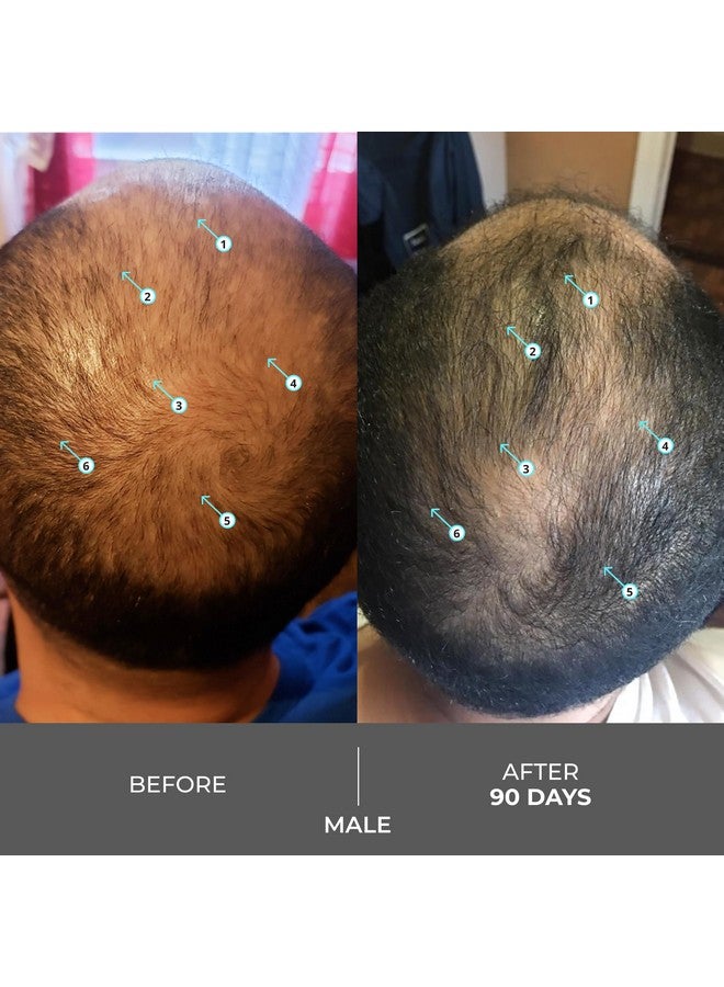 دي أس لابرتوريز شامبو ريفيتا إكسترا سترينث من دي إس لابوراتوريز - شامبو لنمو الشعر، شامبو لتقوية الشعر، مانع لنمو DHT للرجال والنساء، شامبو بيوتين خالٍ من الكبريتات - Image 5