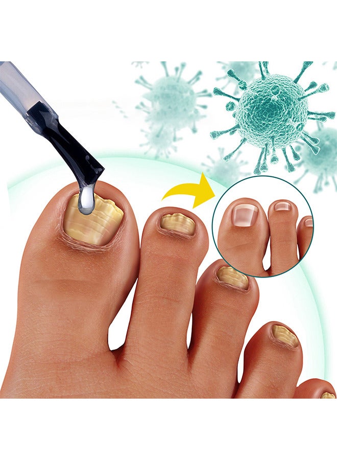 SOUTH MOON Toenail Fungus Treatment Extra Strength-Fungal Nail Treatment for Toe Nail and Fingernails-Nail Repair Solution for Thick/Broken/Discolored Nails-Renews Damaged Cracked Ingrown Toenail - Image 5