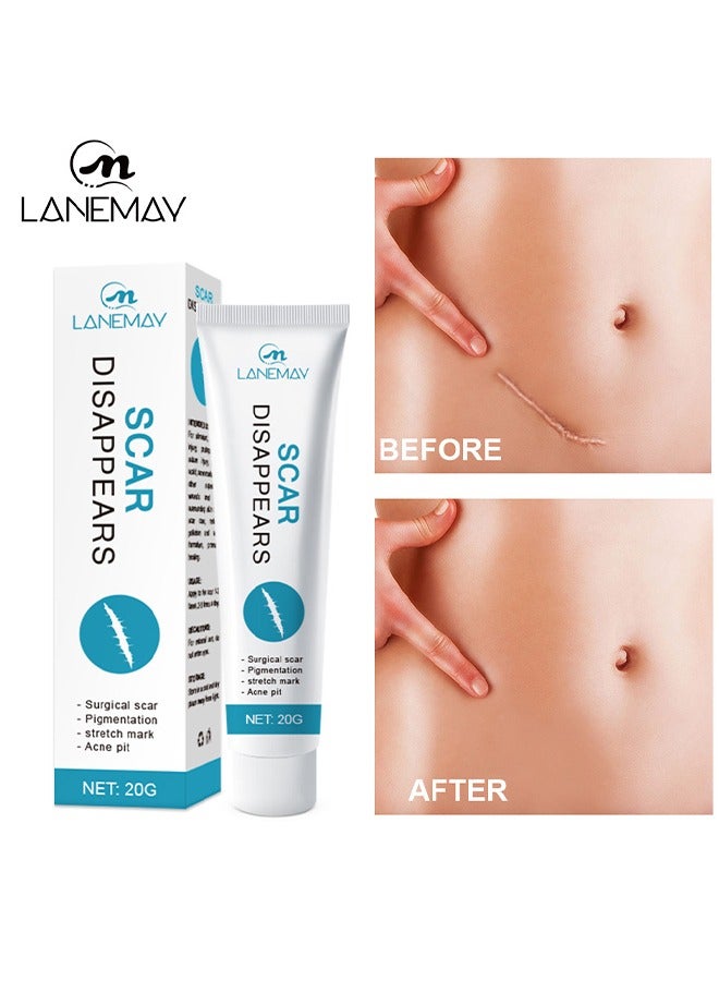 لينماي ندبة يختفي-الطبية الصف سيليكون ندبة كريم جل إزالة ندبة متقدمة للندبات الجراحية علامات التمدد إصابة حب الشباب الحروق الجدرة الضخامي الندوب القديمة والجديدة - Image 1