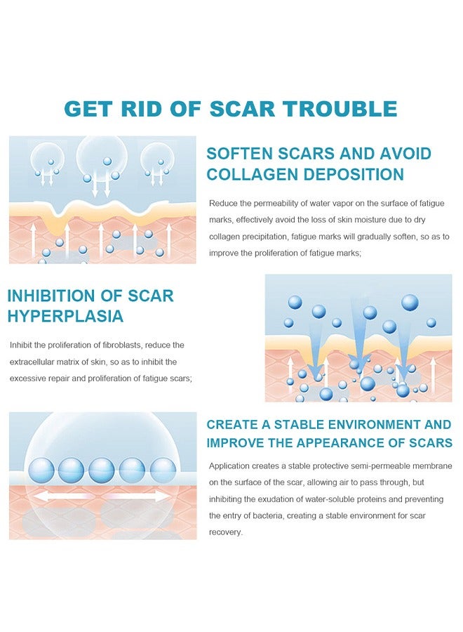 لينماي ندبة يختفي-الطبية الصف سيليكون ندبة كريم جل إزالة ندبة متقدمة للندبات الجراحية علامات التمدد إصابة حب الشباب الحروق الجدرة الضخامي الندوب القديمة والجديدة - Image 3