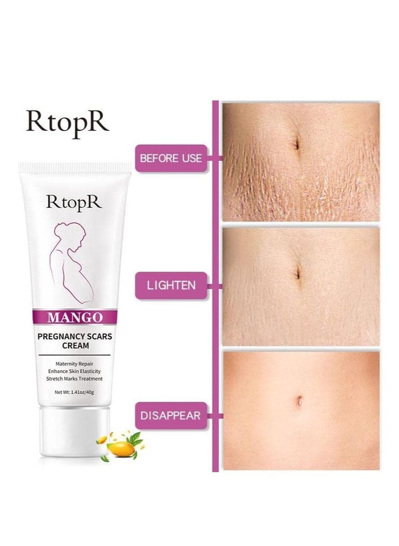 RtopR - Mango Pregnancy Scar Cream Removes Stretch Marks Eliminate Pregnancy Scars Maternity Repair Anti Winkle Anti-Aging Firming Skin Treatment Cream Cream For Pregnant Women 40g - Image 1