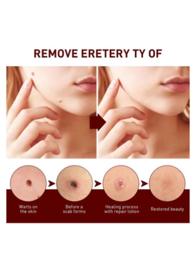 Jaysuing Liquid Wart Flat, Wart Remover Easy to Use Fast Effective Painless Natural Safe Suitable for All Skin Types 1 Pcs  - Image 2
