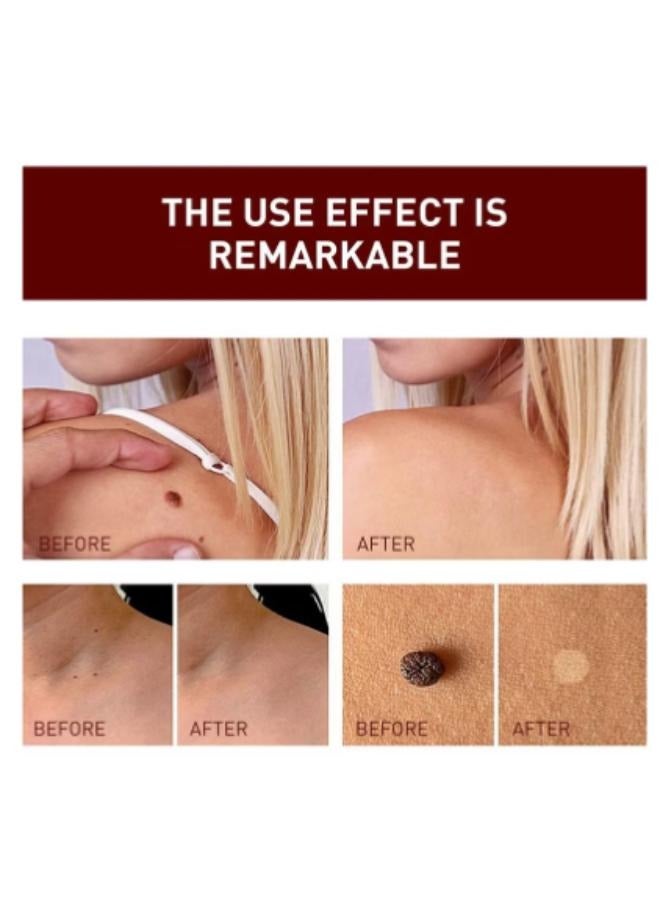 Jaysuing Liquid Wart Flat, Wart Remover Easy to Use Fast Effective Painless Natural Safe Suitable for All Skin Types 1 Pcs  - Image 3