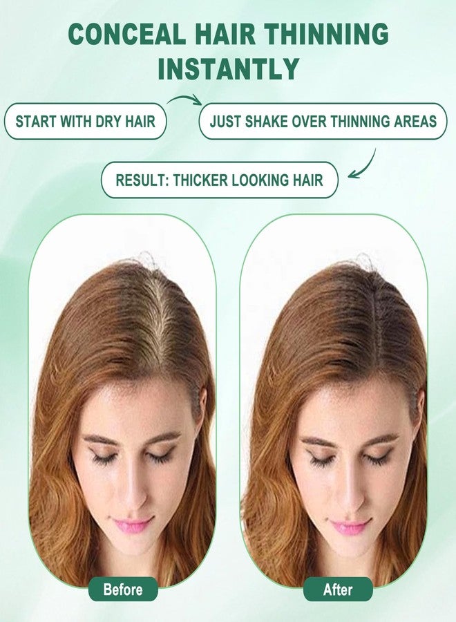 Esermoon Hair Fibers, Hair Fibers for Thinning Hair, Hair Building Fibers, Hairpiece Filler, Increase Hair Density, Styling Powder for Women & Men, Hair Makeup, Premium Formula Thickening (DARK BROWN) - Image 2