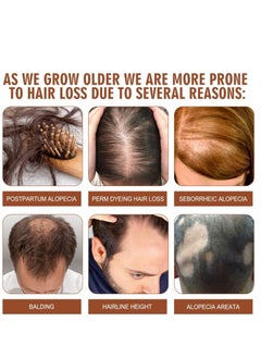 EELHOE Batana Oil for Hair Growth Healthier Thicker Fuller Hair, Batana oil, Batana Oil for Hair Growth, Batana Oil Organic, Batana Oil Organic for Healthy Hair  - Image 3