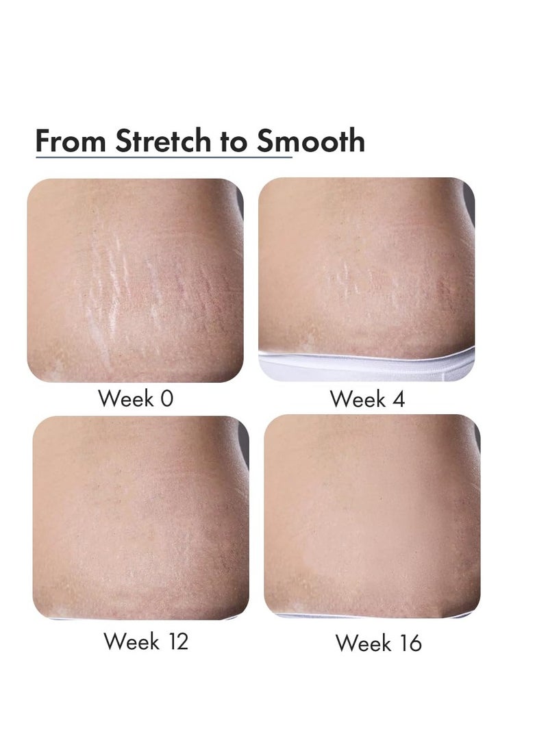 ThriveCo Stretch Marks Expert Serum Cream | For New (red) & Old (white) Stretch Marks Removal & Skin Hydration | Powered by Striover™, Rosehip Oil & Squalane | For Men & Women | 30ml - Image 5