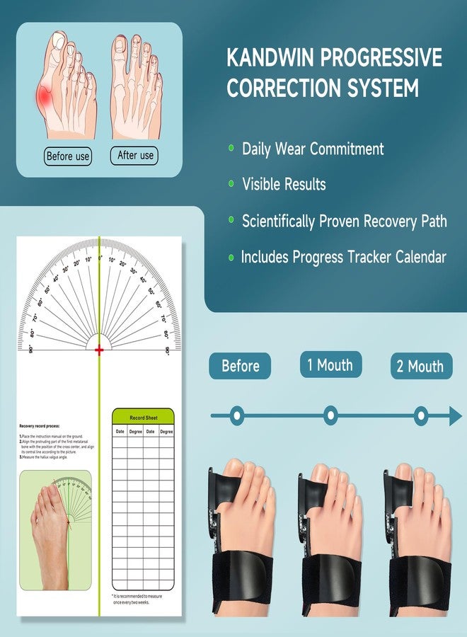 Kandwin Auto-Adaptive Bunion Corrector for Women Men Big Toe, Bunion Relief - Image 5