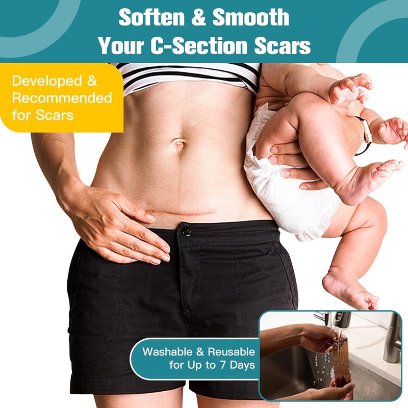 Nine Silicone Scar Thicked SheetsC Section Recovery Kit 2in x 8in 10ct  Reuseable Extra Long Scar Strips for Reducing the Appearance of Keloid BumpStretch MarksBurnSurgical Scar RemovalLatex Free - Image 2