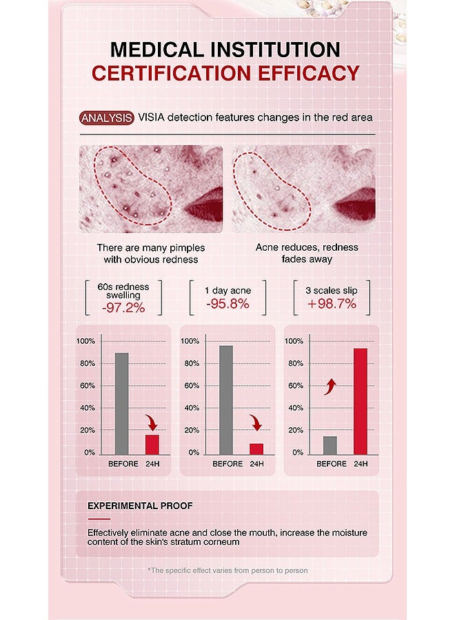 MOIKA Pimple Patches for Face count, Hydrocolloid Acne Pimple Patch for Covering Zits and Blemishes, 36 paches Acne Patches - Image 5