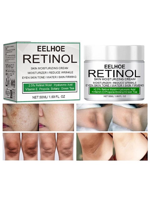 Retinol Skin Moisturizing Cream, Skin Brightening And Lightening Melanin, Elbow And Armpit Moisturizing Cream White 50ML