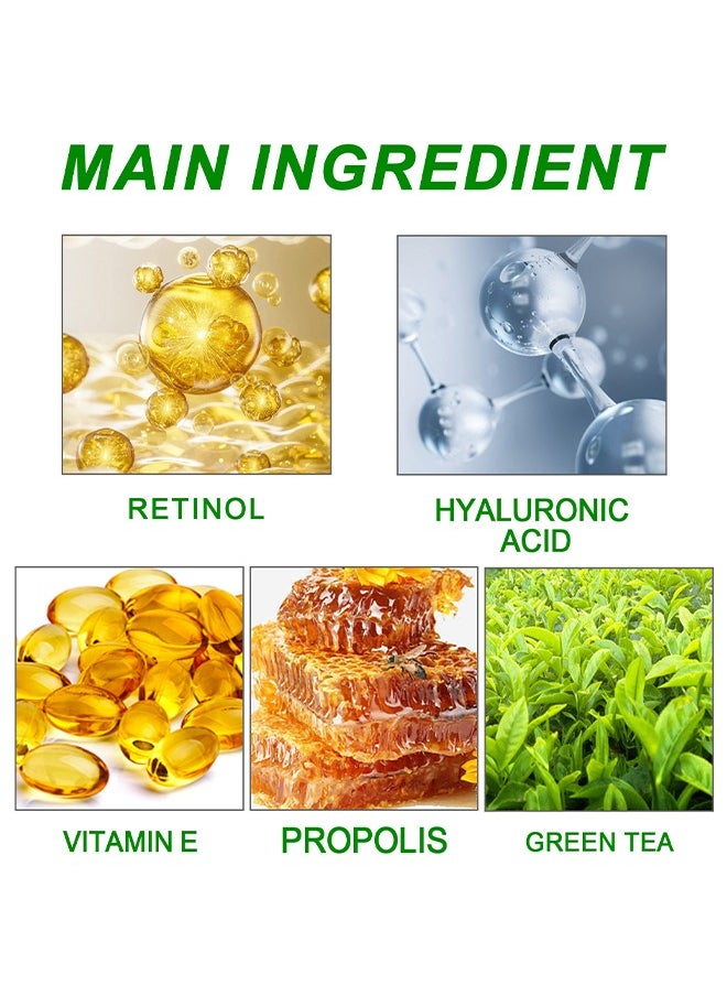 Retinol Skin Moisturizing Cream, Skin Brightening And Lightening Melanin, Elbow And Armpit Moisturizing Cream White 50ML