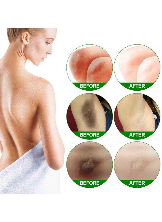 Retinol Skin Moisturizing Cream, Skin Brightening And Lightening Melanin, Elbow And Armpit Moisturizing Cream White 50ML