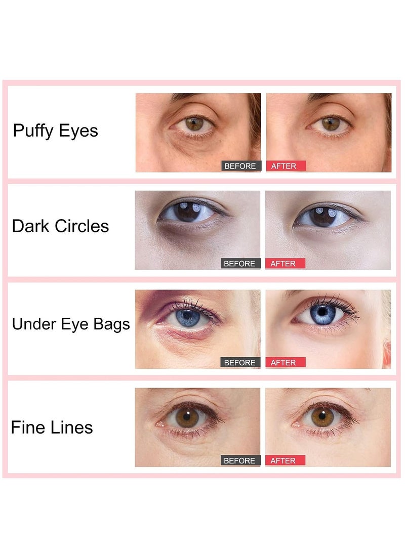 ALIVER Retinol Eye Stick with Collagen and Hyaluronic Acid for Dark Circle Puffiness Eye Bags and Fine Lines Retinol Eye Cream Eye Brightener Stick Under Eye Cream for Anti Aging Improve Eye Skin - Image 2