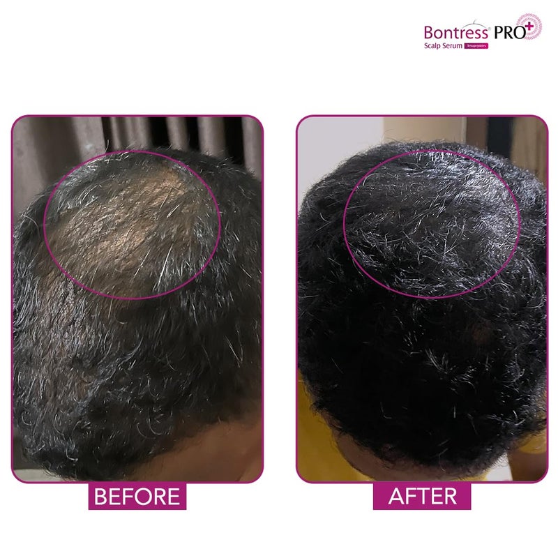 Bontress Pro Hair Serum (60 ml) - Image 5
