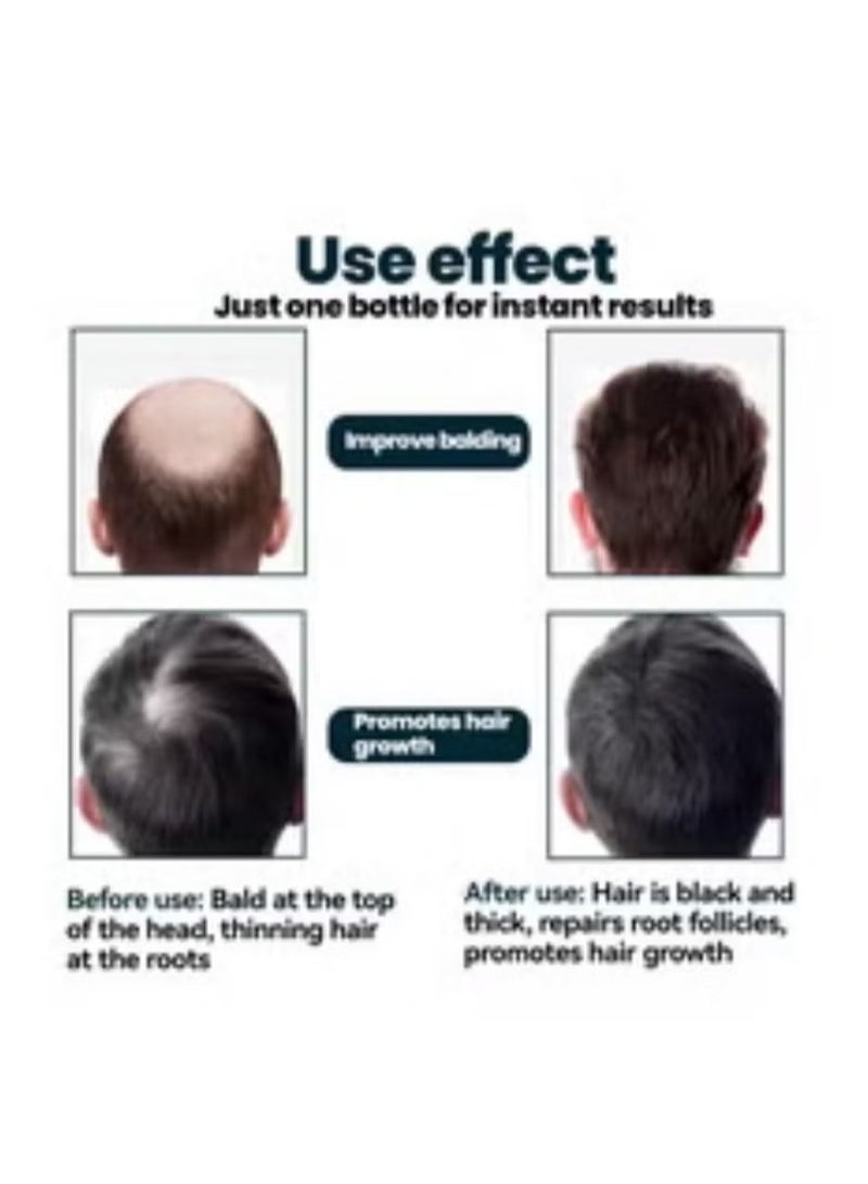 كيركلاند 6 قطع Minoxidil 5 ٪ القوة الإضافية لقوة إعادة نمو الشعر 360 مل （التعبئة والتغليف قد تختلف） - Image 4