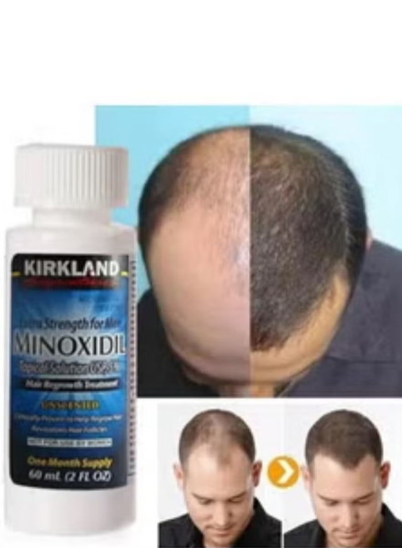 كيركلاند 6 قطع Minoxidil 5 ٪ القوة الإضافية لقوة إعادة نمو الشعر 360 مل （التعبئة والتغليف قد تختلف） - Image 3