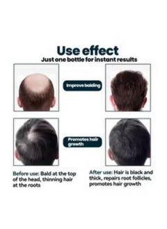 Kirkland 6-Piece Minoxidil 5% Extra Strength Hair Regrowth Treatment 360ml（Packaging may vary）  - Image 4