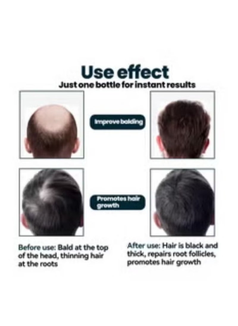 Kirkland - 6-Piece Minoxidil 5% Extra Strength Hair Regrowth Treatment 360ml（Packaging may vary） - Image 1