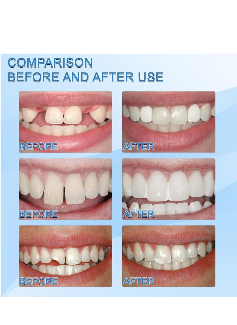ULHYC 30ml Moldable False Teeth White Particles Reusable Non-toxic Temporarily Fill Regain Smile Cosplay DIY  - Image 4